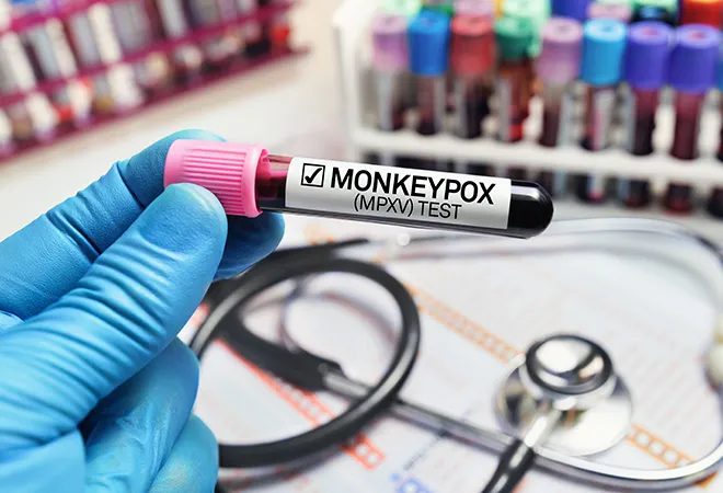 The Monkeypox outbreak: How prepared are we?