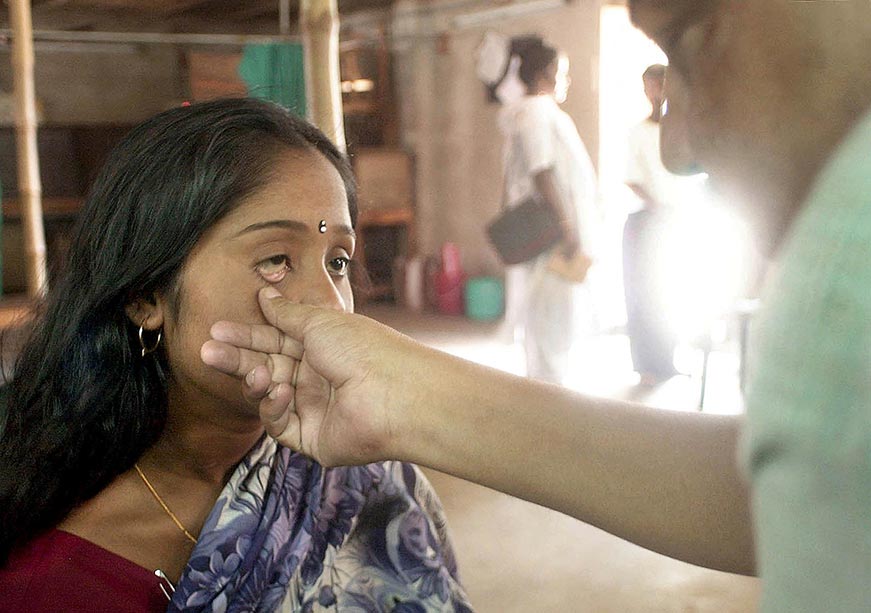 Breaking Anaemia’s Grip: A Mandatory Step Towards Viksit Bharat  