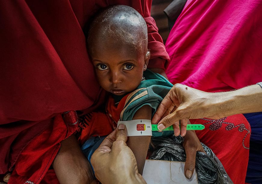 #AmericaAidCuts: कटौती के बाद कैसा रहेगा माँ व शिशु के स्वास्थ्य का भविष्य?